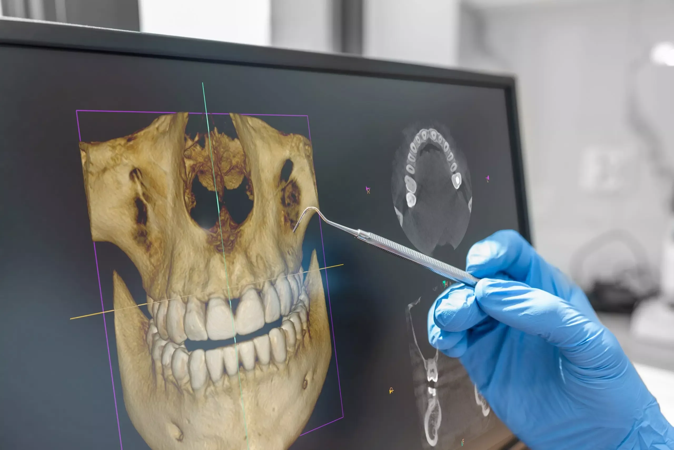 En qué consiste en Cone Beam Dental y para qué sirve