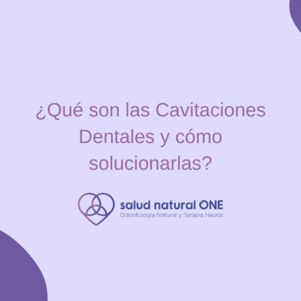 Cavitaciones Dentales, ¿qué son y cómo solucionarlas?