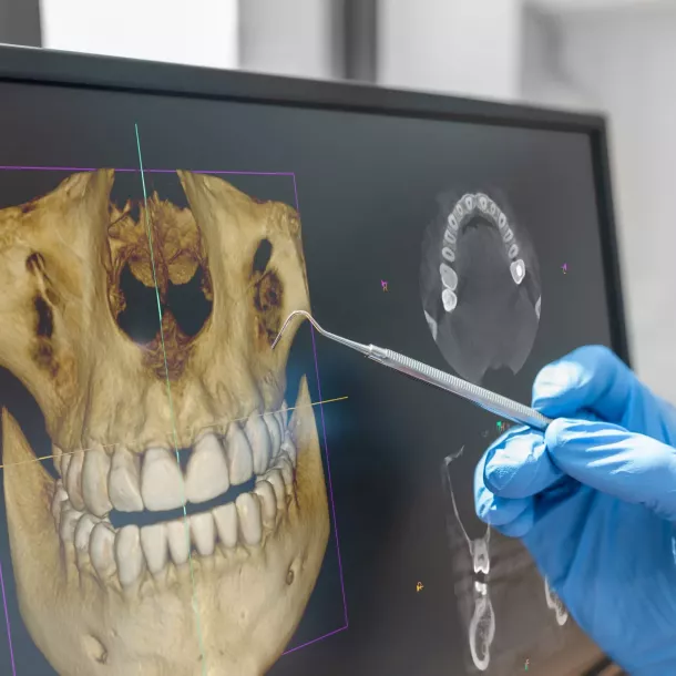 En qué consiste en Cone Beam Dental y para qué sirve