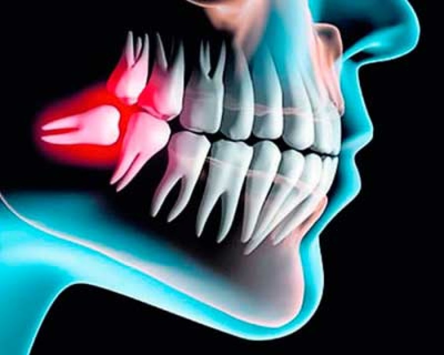 imagen de cirugia oral clinica dental madrid