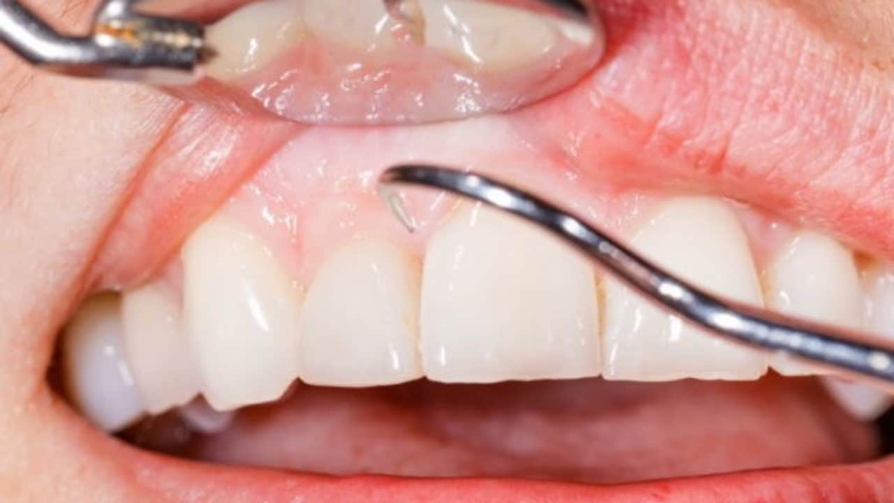 imagen de odontologia preventiva clinica moratalaz