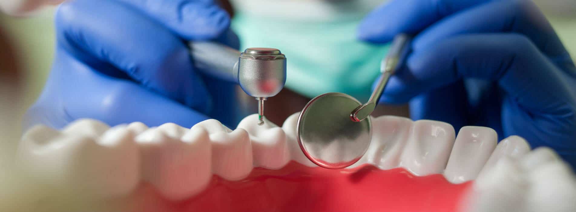 dentista examinando dientes por la posibilidad de endodoncia