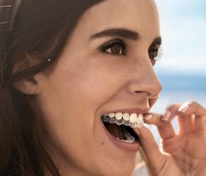 Mujer colocándose ortodoncia invisible