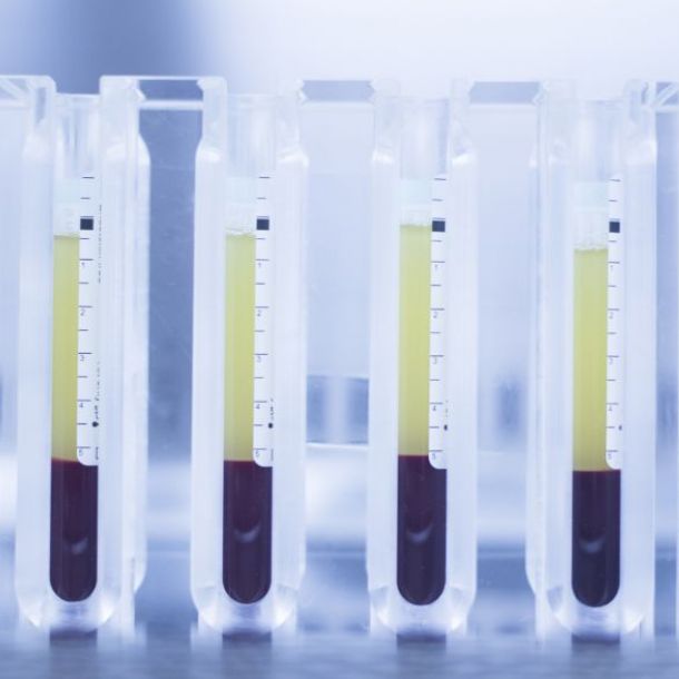 Factores de crecimiento en odontología