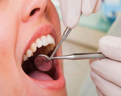 Tratamiento periodoncia en madrid