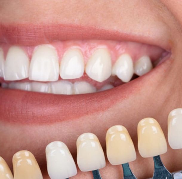 En qué consiste en Cone Beam Dental y para qué sirve 28