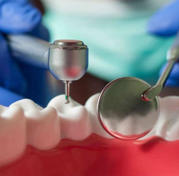 Implantes Circonio Madrid: Guía Completa 2026 - Precio, Ventajas y Comparativa 37