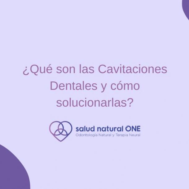 Cavitaciones Dentales, ¿qué son y cómo solucionarlas?