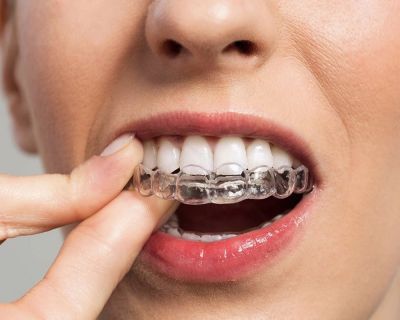 imagen de ortodoncia invisible invisalign madrid