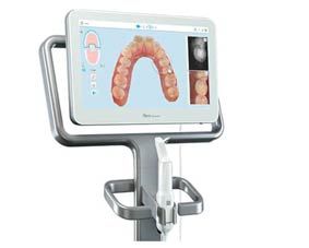 Micro carillas inyectadas