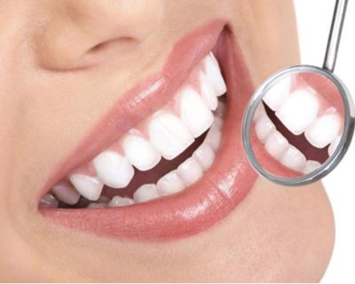 estetica dental