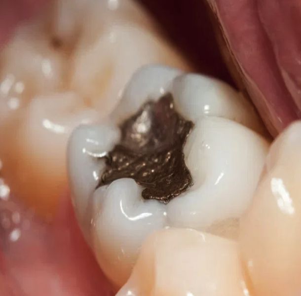 Salud General y Salud Bucodental: Cuidado Natural de tu Boca 31