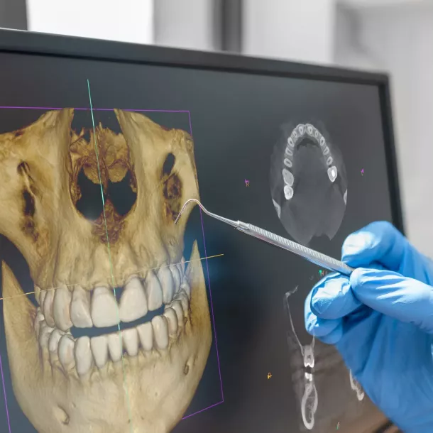 En qué consiste en Cone Beam Dental y para qué sirve