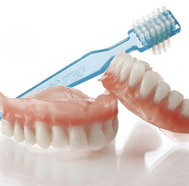 ¿ES MEJOR UN PUENTE DENTAL O IMPLANTES DENTALES? 33