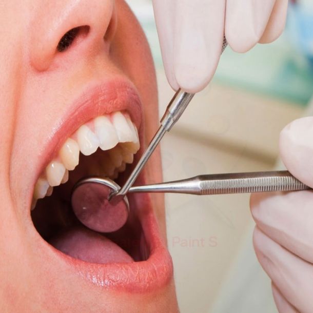 Enfermedad Periodontal