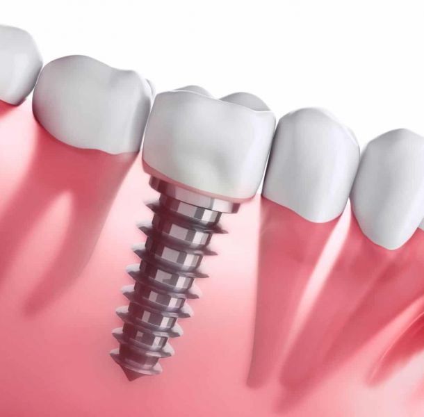 Terapias Complementarias: Enfoque Integral para tu Salud 31